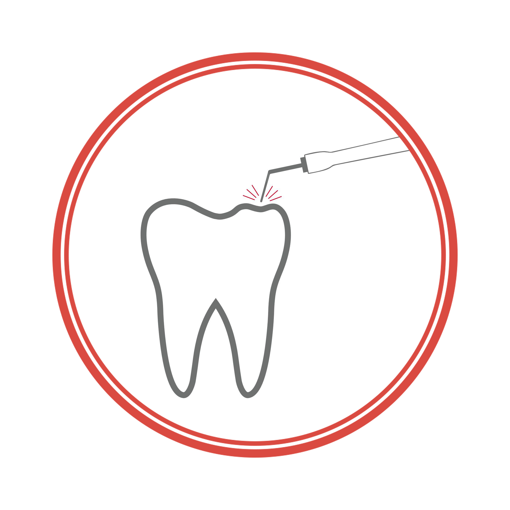 Laser dentistry: from Fundamentals to Advanced Techniques