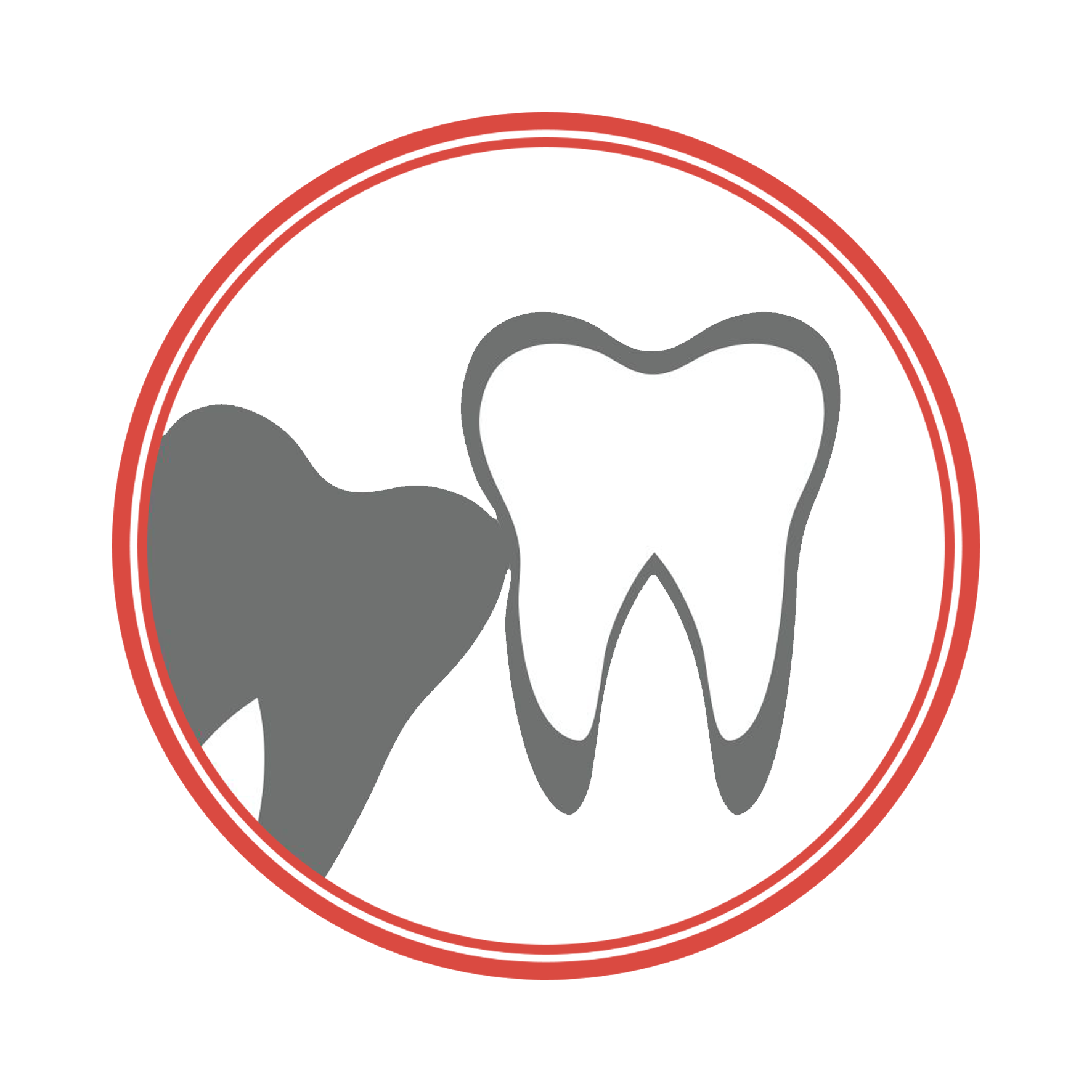 Surgical extraction of the impacted wisdom teeth